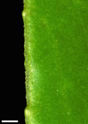 Veronica salicifolia. Leaf margin, showing very short hairs and very obscure, distant teeth. Scale = 1 mm.
 Image: W.M. Malcolm © Te Papa CC-BY-NC 3.0 NZ